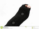 Torn socks